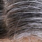 Causes of White Hair and Natural Ways to Prevent White Hair